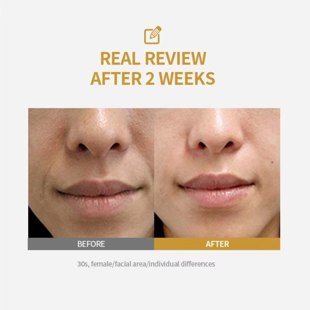 Ampul Pengencang Kulit Intensi - Peptide Complex Serum ulasan dan harga